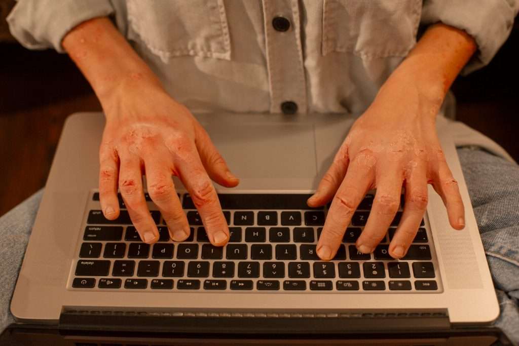 Ancaman di Balik Salah Ketik URL